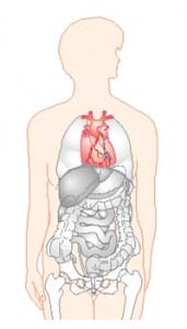 Cardiogene shock Cardiogene shock