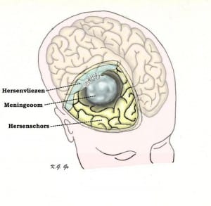 Hersenschorscentra