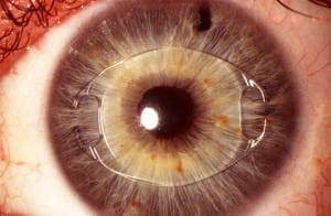 Lens