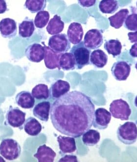 Lymfocyten