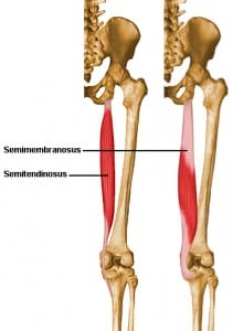 Semimembranosus