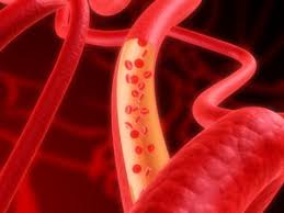 triglyceriden