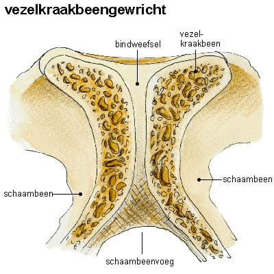 Vezelig-kraakbeenverbinding