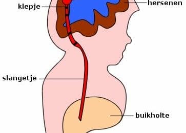 hersenvocht