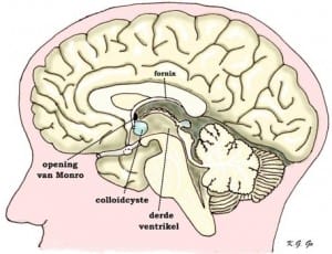 hypofysetumoren