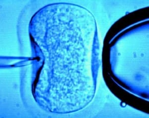 ivf