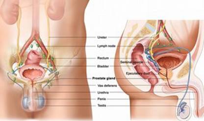 prostatitis