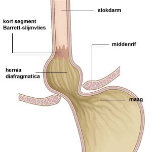 slokdarm slokdarm