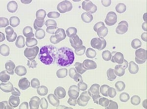 leukocyten