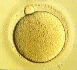 ontogenese