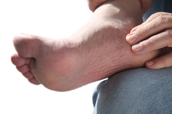 Pijnlijke voeten Algemeen | Menselijk Lichaam