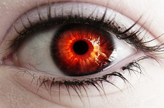 zone last Normaal gesproken Rode ogen | Algemeen | Menselijk Lichaam